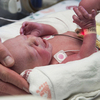 First Baby Born To U.S. Uterus Transplant Patient Raises Ethics Questions