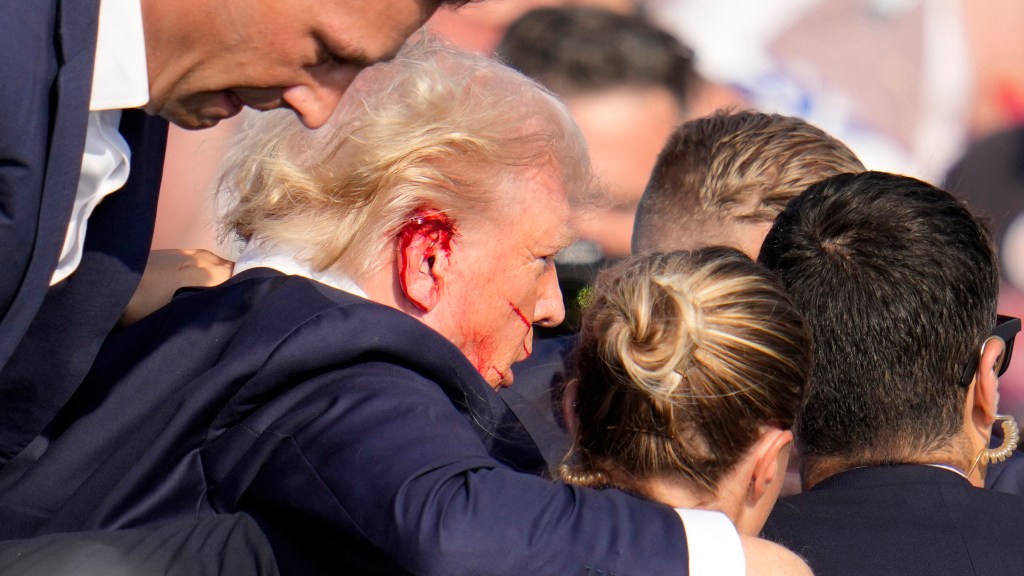 FBI questions whether Trump's ear was directly hit by bullet